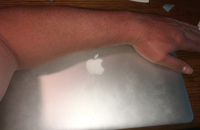 Apple and the ARM Transition